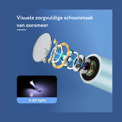 OorXpert™ - De Schoonmaakpro met camera