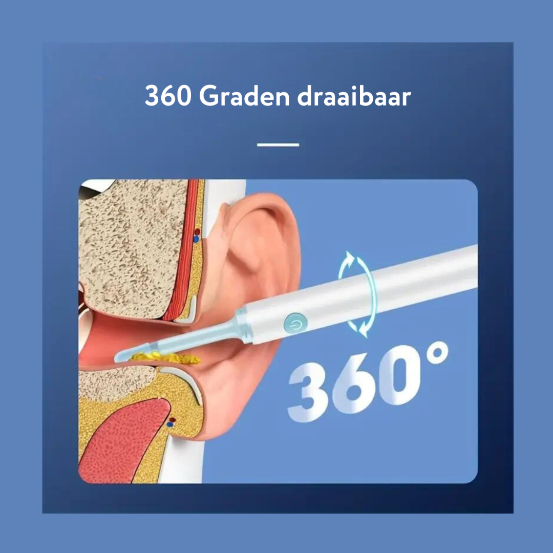 OorXpert™ - De Schoonmaakpro met camera