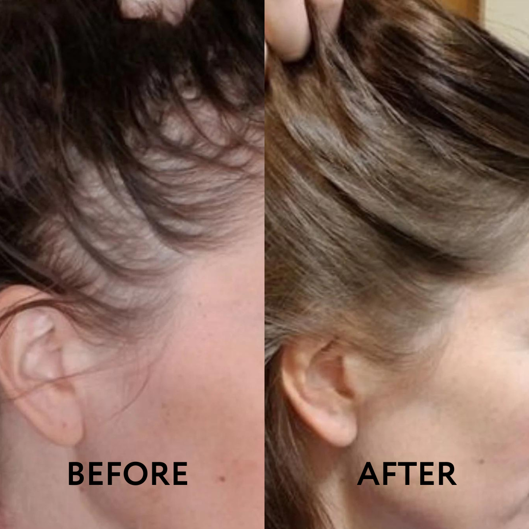 Hair Revolution - Thinning hair? Not with us! 