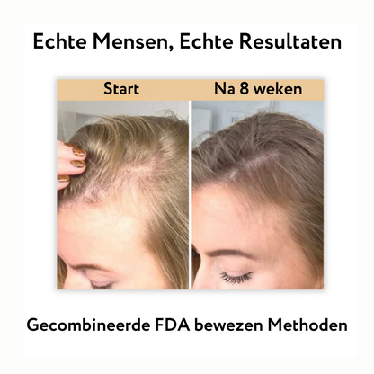 Hair Revolution - Thinning hair? Not with us! 